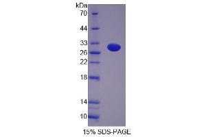 SDS-PAGE analysis of Rat GFM2 Protein. (GFM2 Protein)