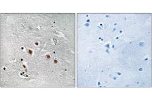 Immunohistochemistry analysis of paraffin-embedded human brain tissue, using MED13L Antibody. (MED13L antibody  (AA 449-498))