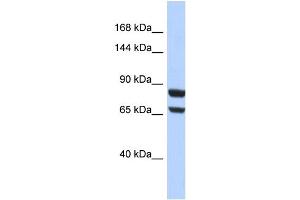 Host:  Rabbit  Target Name:  PGR  Sample Type:  HepG2 Whole cell lysates  Antibody Dilution:  1. (Progesterone Receptor antibody  (N-Term))