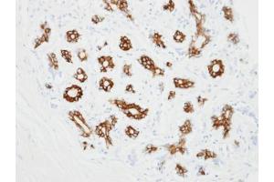 IHC-P Image Immunohistochemical analysis of paraffin-embedded ES2 xenograft, using alpha 2c Adrenergic Receptor, antibody at 1:100 dilution. (ADRA2C antibody  (C-Term))