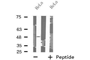 Western blot analysis of extracts from HeLa cells using MRPS27 antibody. (MRPS27 antibody  (N-Term))