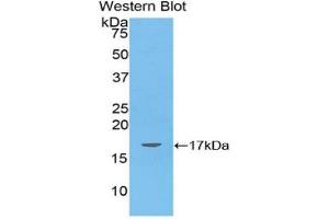 Western blot analysis of the recombinant protein. (ANGPTL4 antibody  (AA 286-409))