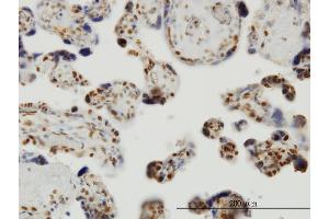 Immunoperoxidase of monoclonal antibody to THUMPD1 on formalin-fixed paraffin-embedded human placenta. (THUMPD1 antibody  (AA 1-353))