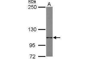 WB Image Sample (20 ug of whole cell lysate) A: human ESC 5% SDS PAGE antibody diluted at 1:2000