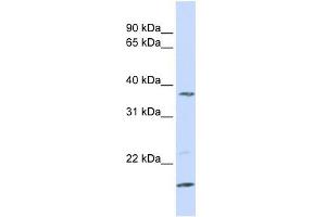 ZDHHC19 antibody used at 1 ug/ml to detect target protein. (ZDHHC19 antibody  (N-Term))