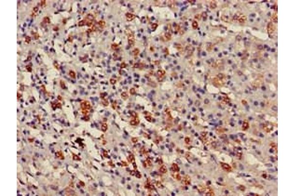 USP6NL antibody  (N-Term)