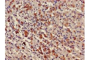 Immunohistochemistry of paraffin-embedded human adrenal gland tissue using ABIN7175158 at dilution of 1:100 (USP6NL antibody  (N-Term))