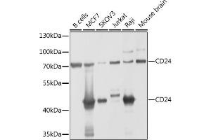 Western blot analysis of extracts of various cell lines, using CD24 antibody (ABIN1512696, ABIN3023213, ABIN3023214 and ABIN6219443) at 1:1000 dilution. (CD24 antibody  (AA 1-80))