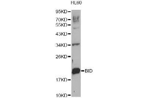 Western blot analysis of extracts of HL-60 cells, using BID Antibody (ABIN1871288). (BID antibody)