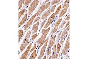 C staining MFN2 in human heart tissue sections by Immunohistochemistry (IHC-P - paraformaldehyde-fixed, paraffin-embedded sections). (MFN2 antibody  (AA 447-476))