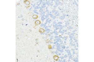 Immunohistochemistry of paraffin-embedded rat cerebellum using RPL10A Rabbit pAb (ABIN6129099, ABIN6147103, ABIN6147104 and ABIN6221624) at dilution of 1:100 (40x lens). (RPL10A antibody  (AA 1-110))