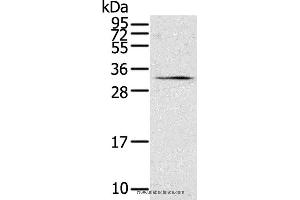 Western blot analysis of 231 cell, using STAR Polyclonal Antibody at dilution of 1:500 (STAR antibody)