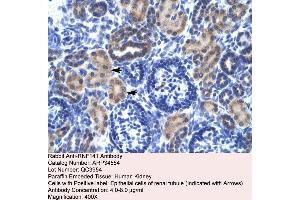 Human kidney (RNF141 antibody  (Middle Region))