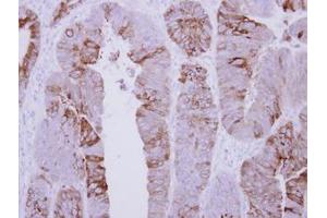 Image no. 1 for anti-AChE Q Subunit (COLQ) (AA 248-455) antibody (ABIN1497560) (COLQ antibody  (AA 248-455))