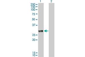 Western Blot analysis of MGC40579 expression in transfected 293T cell line by MGC40579 monoclonal antibody (M11), clone 2C11. (GK5 antibody  (AA 1-89))