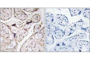 Immunohistochemistry analysis of paraffin-embedded human placenta tissue, using PHCA Antibody. (ACER3 antibody  (AA 171-220))