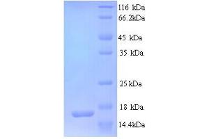 SDS-PAGE (SDS) image for Glutamate Receptor, Ionotropic, AMPA 3 (GRIA3) (AA 151-250), (partial) protein (His tag) (ABIN5713486) (Glutamate Receptor 3 Protein (AA 151-250, partial) (His tag))