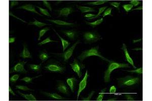 Immunofluorescence of monoclonal antibody to S100P on HeLa cell. (S100P antibody  (AA 1-69))