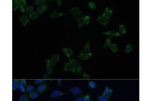 Immunofluorescence analysis of HeLa cells using SS18L1 Polyclonal Antibody at dilution of 1:100. (SS18L1 antibody)