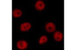 Immunofluorescence (fixed cells) (IF/ICC) image for anti-SNAIL (SNAI1) (C-Term) antibody (ABIN6265200)