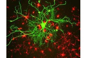 Immunostaining of cultured rat neurons with anti-mouse neurofilament L (green) and anti-rabbit alpha internexin. (NEFL antibody)