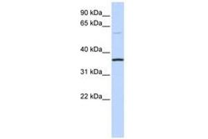 Image no. 1 for anti-Chromosome 16 Open Reading Frame 46 (C16ORF46) (AA 108-157) antibody (ABIN6741192) (C16ORF46 antibody  (AA 108-157))