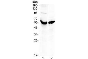 Western blot testing of human 1) placenta and 2) A431 lysate with VDBP antibody at 0.