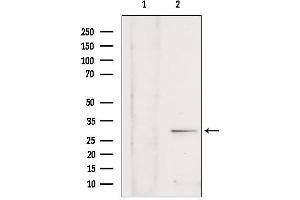 Western blot analysis of extracts from rat brain, using SULT4A1 antibody.