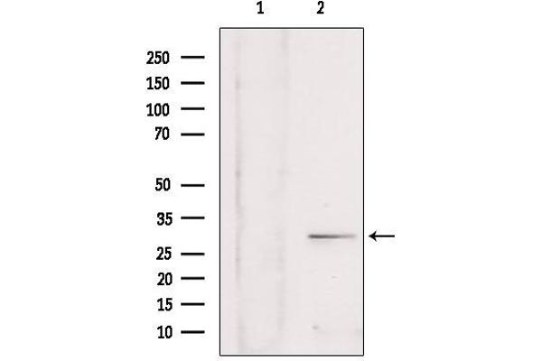 SULT4A1 antibody  (C-Term)