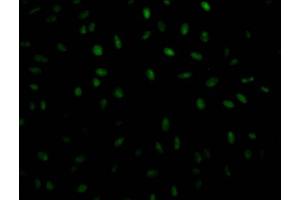 Immunofluorescence (IF) image for anti-Poly A Binding Protein Nuclear 1 (PABPN1) antibody (ABIN7127661)