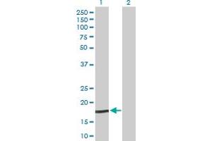 NPC2 antibody  (AA 1-151)