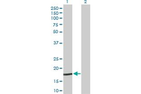 NPC2 抗体  (AA 1-151)