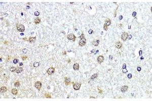 Immunohistochemistry (Paraffin-embedded Sections) (IHC (p)) image for anti-Small Ubiquitin Related Modifier Protein 1 (SUMO1) antibody (ABIN7260199)
