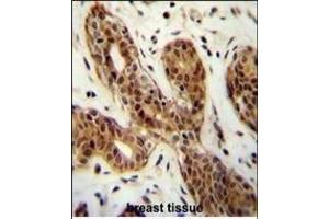 C Antibody (N-term) (ABIN655004 and ABIN2844639) immunohistochemistry analysis in formalin fixed and paraffin embedded human breast tissue followed by peroxidase conjugation of the secondary antibody and DAB staining. (CI150 antibody  (N-Term))