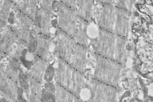 Immunoelectron microscopy analysis of LR white resin-embedded mouse heart using alpha Actinin 2 (ABIN7075510) at dilution of 1: 50. (Sarcomeric alpha Actinin antibody)