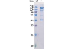 Human PMEL Protein, hFc Tag on SDS-PAGE under reducing condition.
