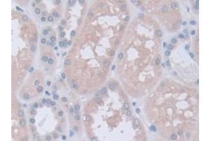 DAB staining on IHC-P; Samples: Human Kidney Tissue (Inversin antibody  (AA 1-237))