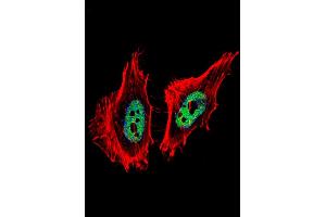 Fluorescent confocal image of Hela cell stained with CTBP1 Antibody . (CTBP1 antibody  (C-Term))