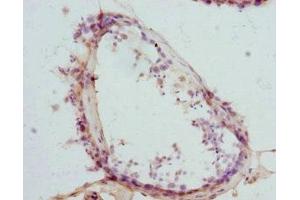 Immunohistochemistry of paraffin-embedded human testis tissue using ABIN7145457 at dilution of 1:100 (CTNNBL1 antibody  (AA 264-563))