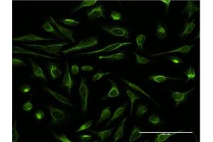 Immunofluorescence of monoclonal antibody to DBR1 on HeLa cell. (DBR1 antibody  (AA 445-538))