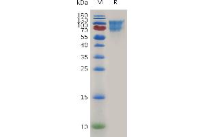 SDS-PAGE (SDS) image for CD34 (CD34) (AA 35-287) protein (Fc Tag) (ABIN7491127)