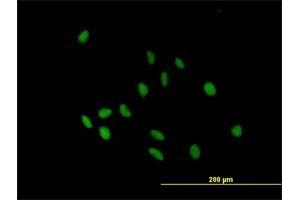 Immunofluorescence of purified MaxPab antibody to IGHA2 on HeLa cell. (IGHA2 antibody  (AA 1-477))