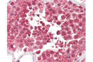 Anti-CILD9 / DNAI2 antibody IHC staining of human testis. (DNAI2 antibody  (AA 71-120))