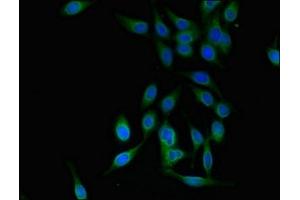 Immunofluorescent analysis of Hela cells using ABIN7151322 at dilution of 1:100 and Alexa Fluor 488-congugated AffiniPure Goat Anti-Rabbit IgG(H+L) (TRIM25 antibody  (AA 81-272))
