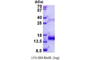 SDS-PAGE (SDS) image for Olfactomedin 1 (OLFM1) (AA 34-135) protein (His tag) (ABIN5853009) (Olfactomedin 1 Protein (OLFM1) (AA 34-135) (His tag))