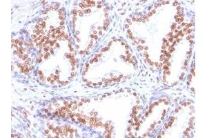 Image no. 1 for anti-Androgen Receptor (AR) antibody (ABIN6156188) (Androgen Receptor antibody)