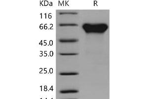 Western Blotting (WB) image for Activin RIIA / ACVR2A (Active) protein (His tag,Fc Tag) (ABIN7194141) (Activin RIIA / ACVR2A (Active) protein (His tag,Fc Tag))