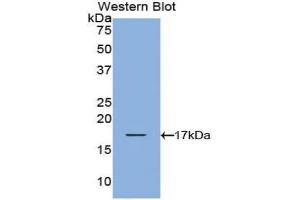 Western blot analysis of the recombinant protein. (TCL1A antibody  (AA 1-114))
