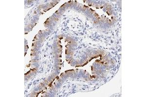 Immunohistochemical staining of human fallopian tube with WDR65 polyclonal antibody ( Cat # PAB27990 ) shows strong membranous positivity in glandular cells at 1:50 - 1:200 dilution.