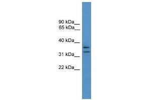 Western Blot showing SCAMP3 antibody used at a concentration of 1-2 ug/ml to detect its target protein. (SCAMP3 antibody  (N-Term))